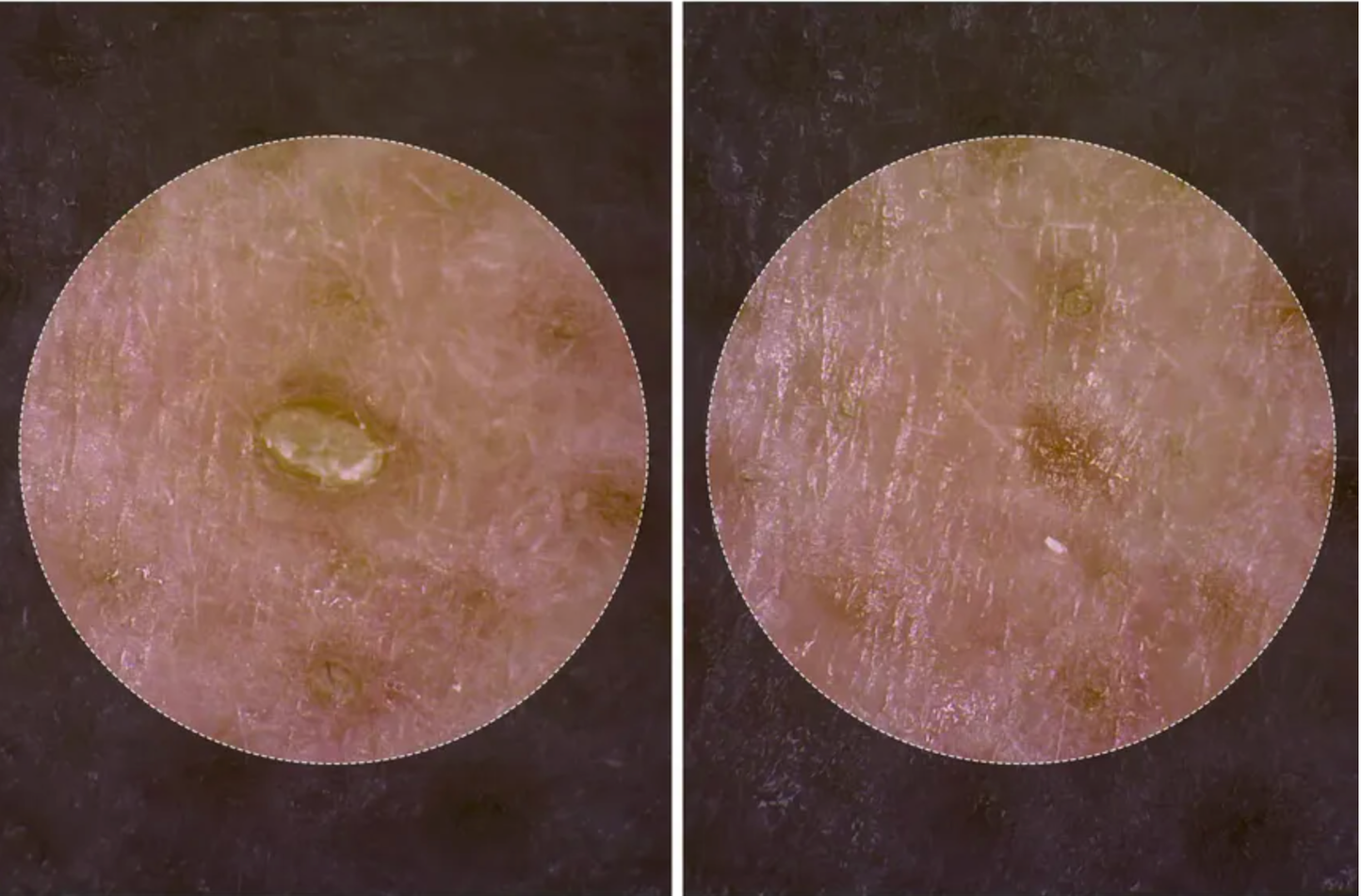 Dr.Melaxin Peel Shots