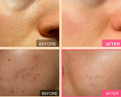 Dr.Melaxin Peel Shots