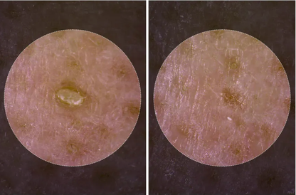 Dr.Melaxin Peel Shots